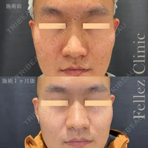 Fellez Clinic【フェルズクリニック】の症例