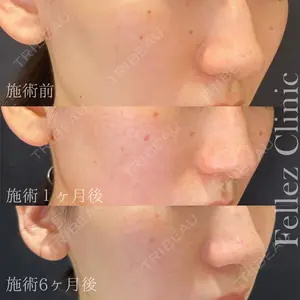 Fellez Clinic【フェルズクリニック】の症例