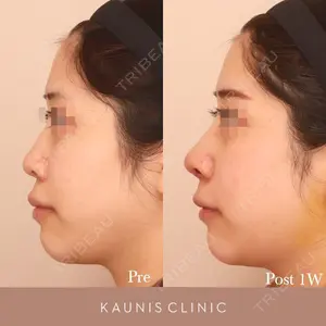 KAUNIS CLINIC（カウニスクリニック）の症例