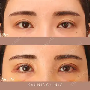 KAUNIS CLINIC（カウニスクリニック）の症例