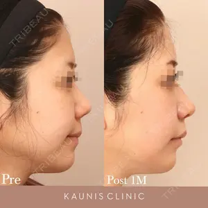 KAUNIS CLINIC（カウニスクリニック）の症例