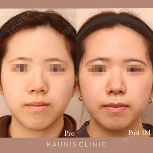 KAUNIS CLINIC（カウニスクリニック）の症例