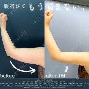 湘南美容クリニック 渋谷院 川口 理夏医師の症例