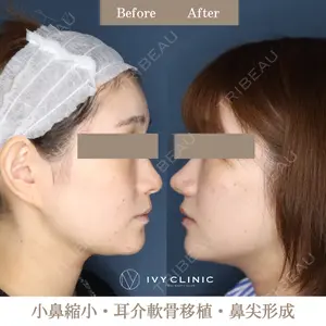 吉祥寺アイビークリニックの症例