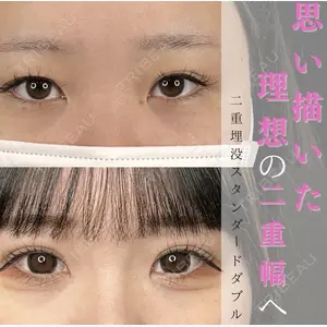 藤・ナチュレ美容クリニック 銀座院 藍 嵐医師の症例