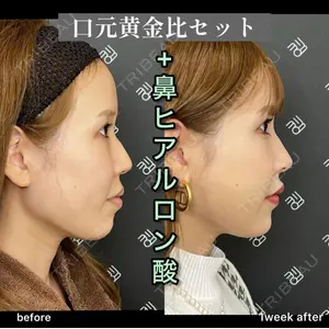 EMMO FACE CLINIC 大阪梅田院 山﨑 冴羅医師の症例