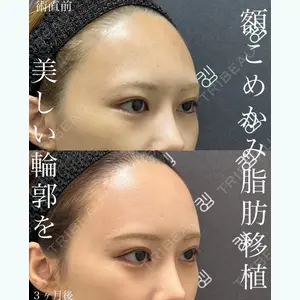 EMMO FACE CLINIC 大宮院 廣松 直樹医師の症例