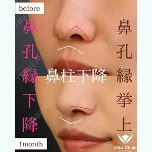 Otus Clinic 【オータスクリニック】 中 徳太郎医師の症例