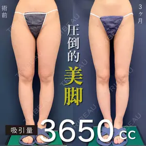 東京シンデレラ美容外科 新宿院 吉原 伯医師の症例