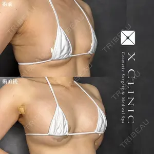 X CLINIC 福岡天神院 倉光　瞳医師の症例