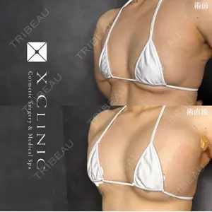 X CLINIC 福岡天神院 倉光　瞳医師の症例
