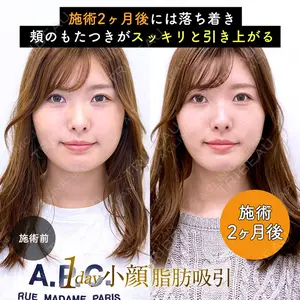 A CLINIC（エークリニック）横浜院 柴田 貴志医師の症例