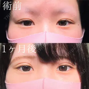 HAAB×DREAM BEAUTY CLINIC 大阪梅田院 鈴木 馨斗医師の症例