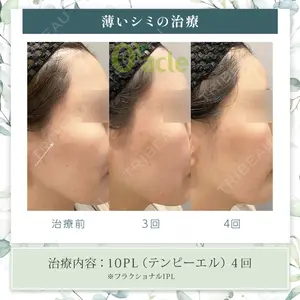 オラクル美容皮膚科 東京新宿院の症例