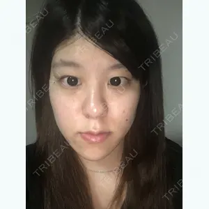id美容外科 ヒョン･ウォンソク医師の症例