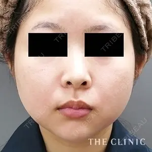 THE CLINIC（ザ・クリニック）名古屋院 福田越医師の症例