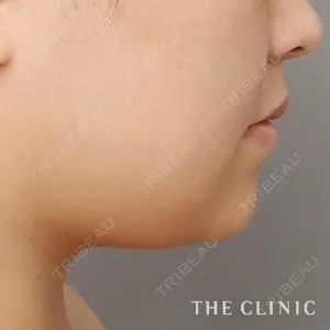 THE CLINIC（ザ・クリニック）東京院 中居弘一医師の症例