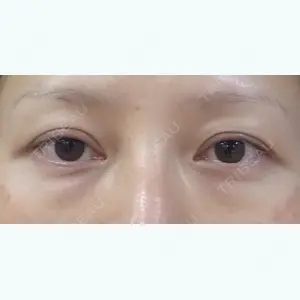 リッツ美容外科 大阪院 志賀　由章医師の症例