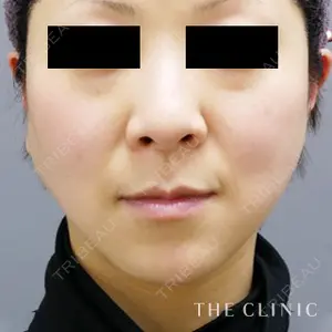 THE CLINIC（ザ・クリニック）名古屋院 福田越医師の症例