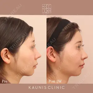KAUNIS CLINIC（カウニスクリニック） 高野 敏郎医師の症例