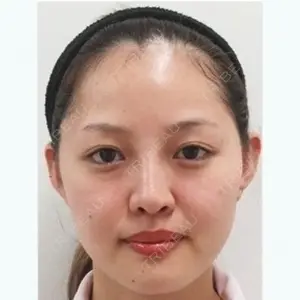 水の森美容外科 東京銀座院 雜賀俊行医師の症例