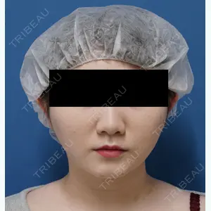 もとび美容外科クリニック新宿院 西尾 謙三郎医師の症例