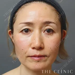 THE CLINIC（ザ・クリニック）東京院 加藤敏次医師の症例