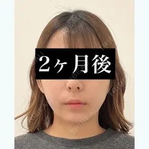 藤・ナチュレ美容クリニック 銀座院 東　康晴医師の症例