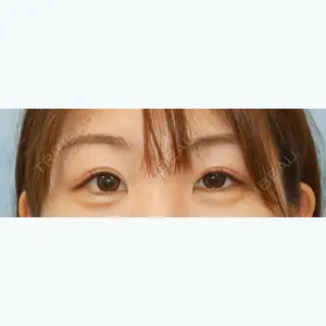 新宿美容外科クリニック 横浜院 吉田　行貴医師の症例