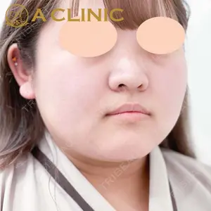 A CLINIC（エークリニック） 銀座院 小松 塁医師の症例