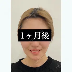 藤・ナチュレ美容クリニック 銀座院 東　康晴医師の症例