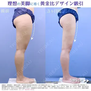 湘南美容クリニック 新宿本院 須田 陽一医師の症例