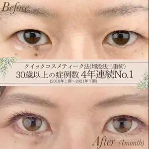 湘南美容クリニック 新宿本院 金 児美医師の症例