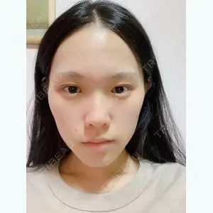DA美容外科 LEE SANG WOO医師の症例