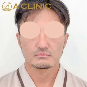 A CLINIC（エークリニック） 銀座院 田窪 賢志郎医師の症例