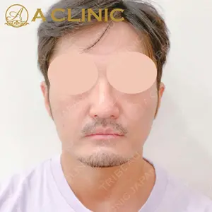 A CLINIC（エークリニック） 銀座院 田窪 賢志郎医師の症例