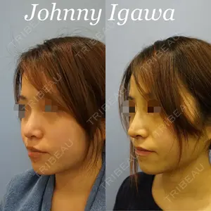 湘南美容クリニック 新宿本院 居川 和広医師の症例