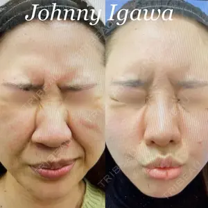 湘南美容クリニック 新宿本院 居川 和広医師の症例