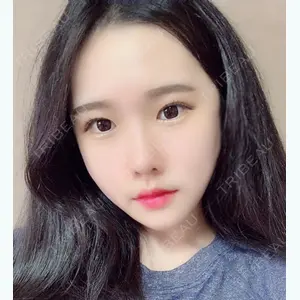 DA美容外科 LEE SANG WOO医師の症例