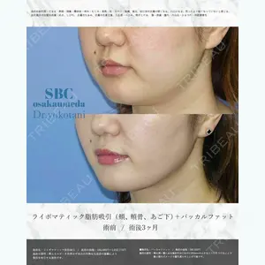 湘南美容クリニック 大阪梅田院 横谷 仁彦医師の症例