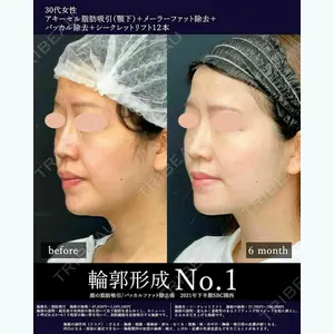湘南美容クリニック 大阪梅田院 横谷 仁彦医師の症例
