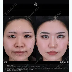 湘南美容クリニック 仙台院 田中 龍二医師の症例