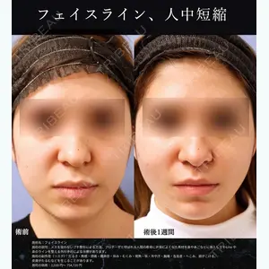 湘南美容クリニック 仙台院 田中 龍二医師の症例