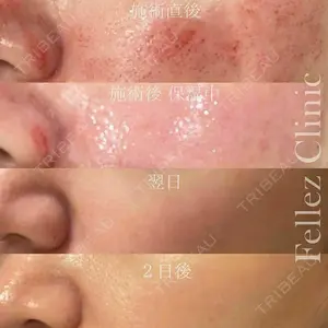 Fellez Clinic【フェルズクリニック】 小野 泰寛医師の症例