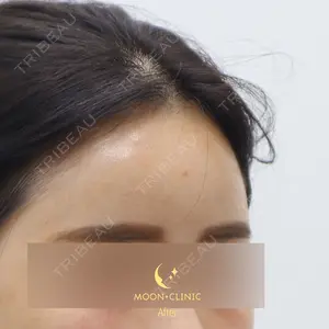 ムーンクリニック（MOON CLINIC） Kim Serae医師の症例
