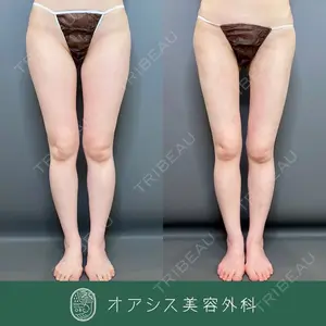 オアシス美容外科 遠藤剛史医師の症例