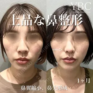 YBC横浜美容外科 大宮院 磯村 亮輔医師の症例