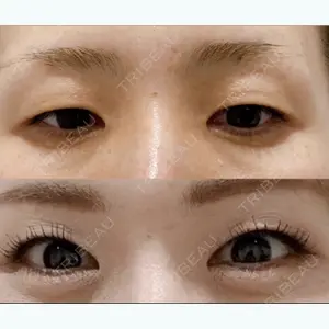 グランメドクリニック茨木 岡田　大輔医師の症例