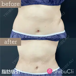 渋谷美容外科クリニック 新橋院 藏薗 侑人医師の症例