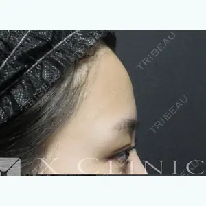 X CLINIC 恵比寿院 孫 駿一郎医師の症例
